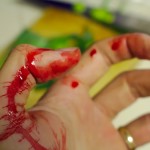 cut finger_opt